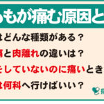 太ももが痛む原因とはアイキャッチ